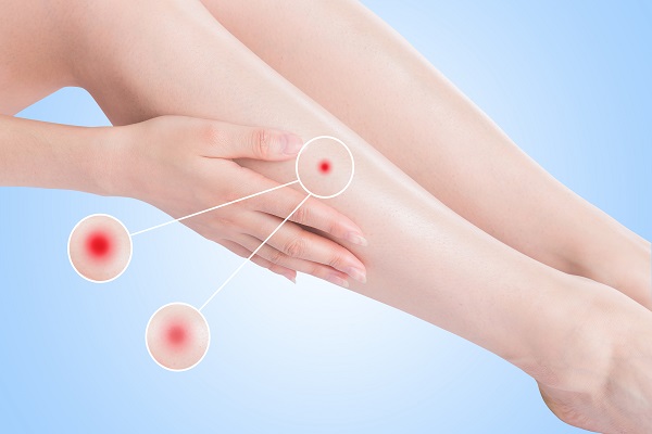 ���������ºڰ���ô��ȥ���ڰ̵���Ч��ʩ��